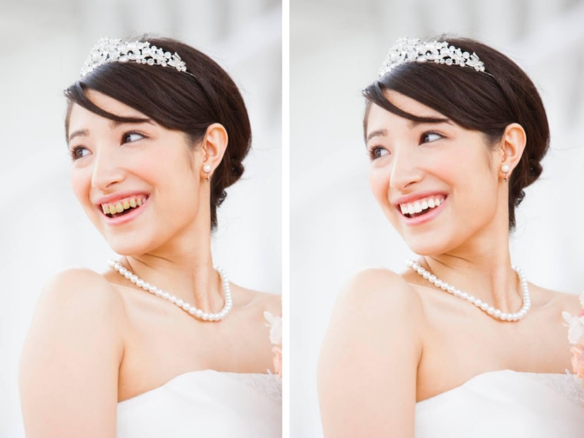 ブライダルエステ