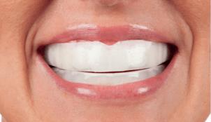 オパールエッセンスGOの使用方法