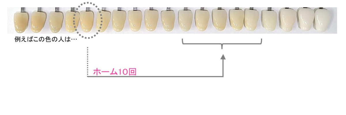 ホームホワイトニング