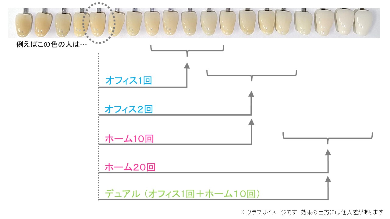 私にはどの方法？