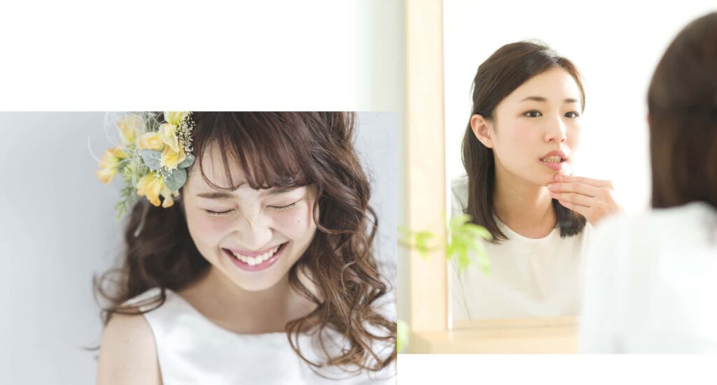 輝く花嫁には、白いドレスに白い歯がよく似合う