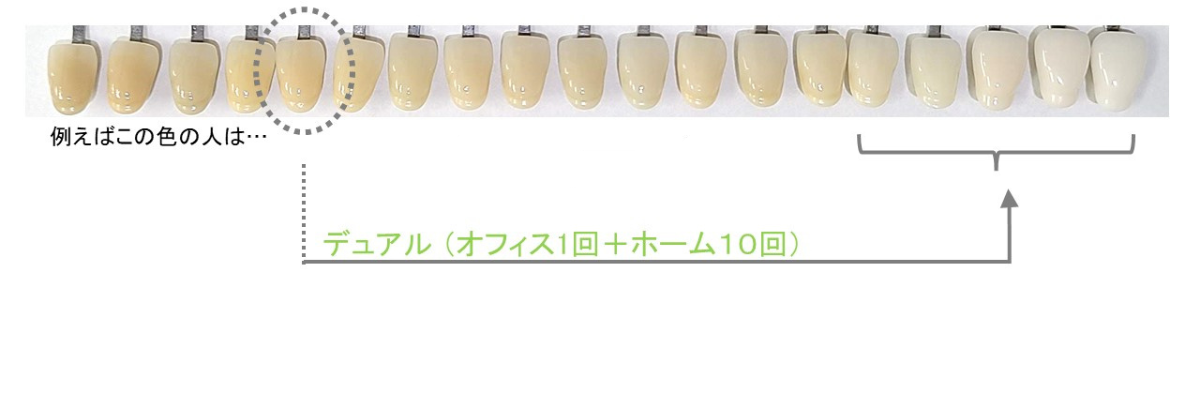 デュアルホワイトニング